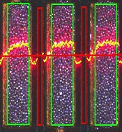 laser based technology profile1 SMT & SPI - Automated AOI